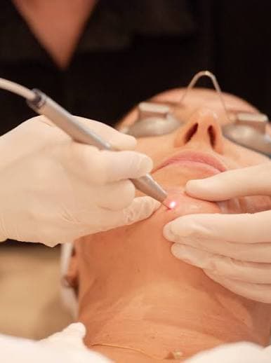 IPL / Fotofacial