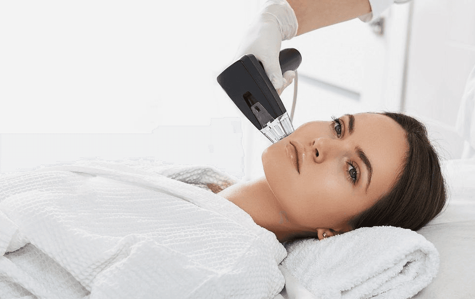 RF microneedling eller fraksjonell CO2-laser – hvordan velger legen?