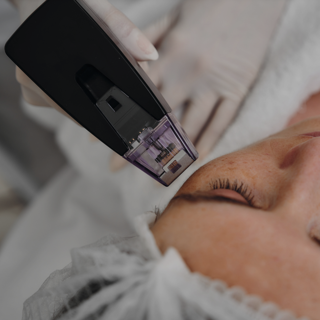 RF Microneedling teknologi